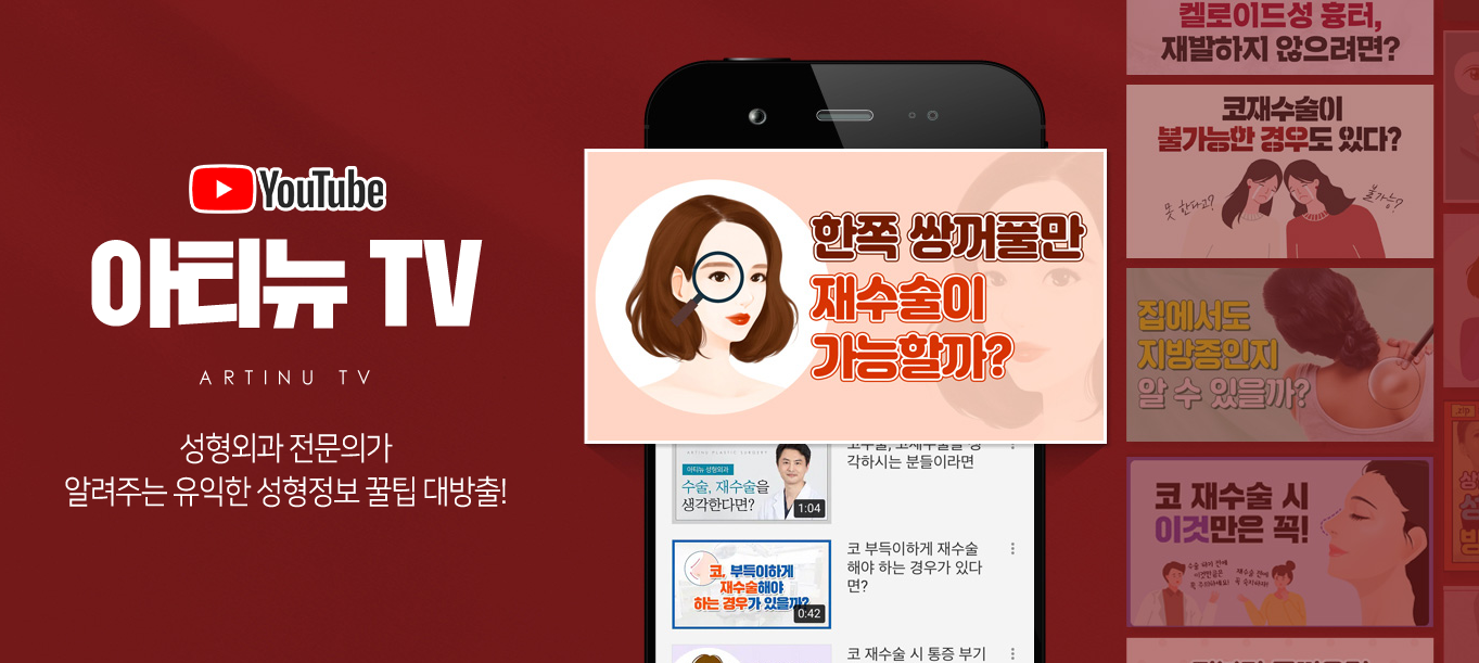 아티뉴성형외과 안내 배너