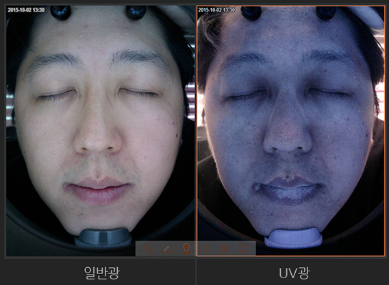 다양한 조명으로 피부 관찰