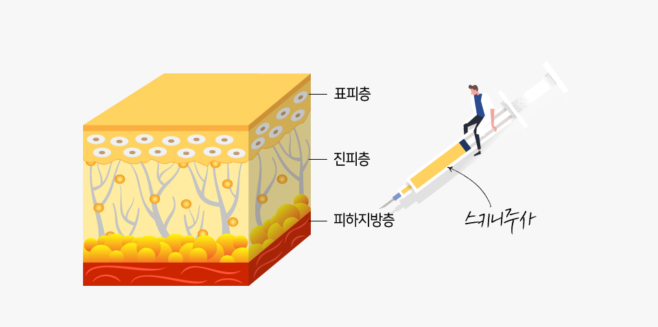 스키니주사 지방 분해 과정 이미지