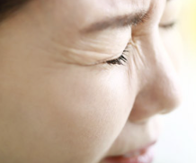 주름 보톡스 시술 부위 — 눈가·미간 주름