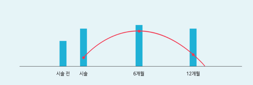 보톡스 효과·지속시간 — 시술 전, 시술, 6개월, 12개월