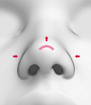 CASE 03 STEP 02