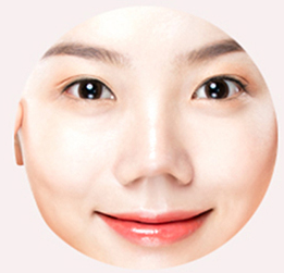 들창코