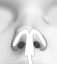 CASE 02 STEP 02