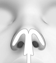 CASE 02 STEP 03
