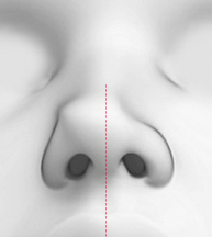 CASE 03 STEP 01