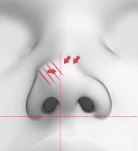 CASE 03 STEP 02