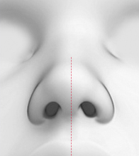 CASE 03 STEP 03