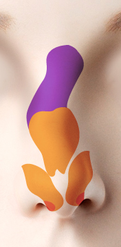C형